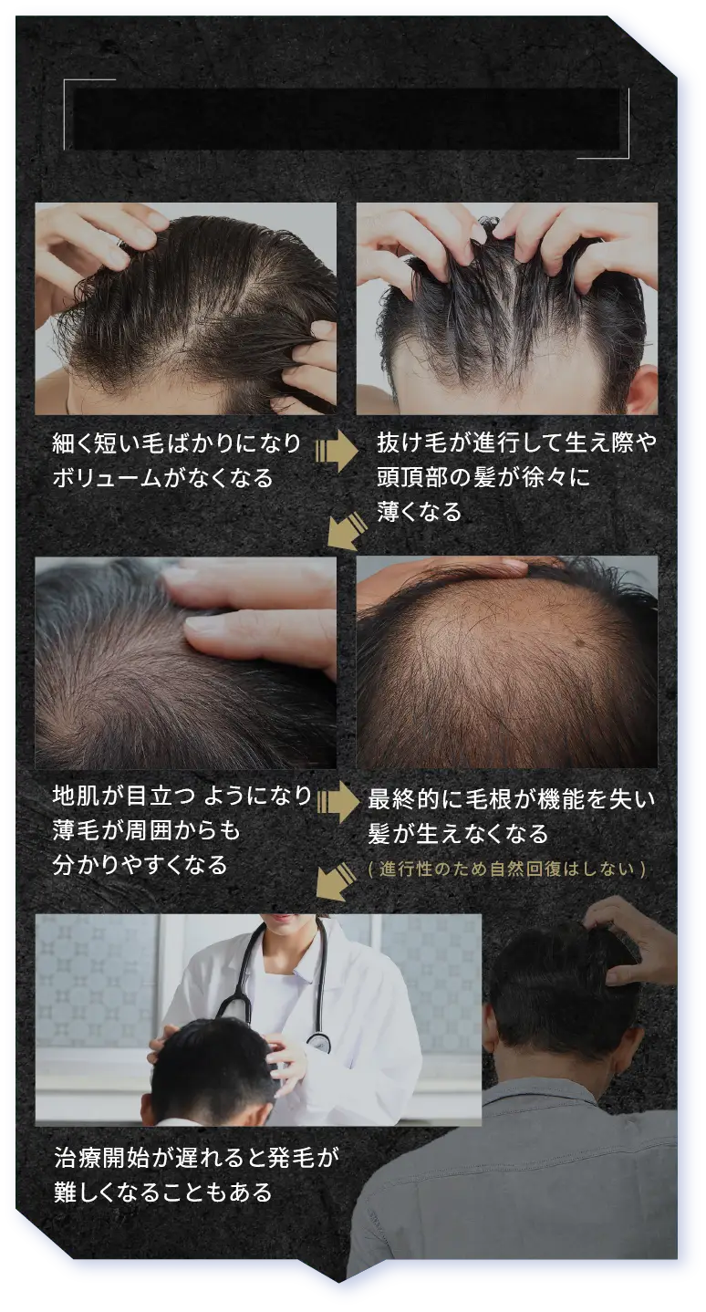 最終的に生えなくなる、発毛が困難