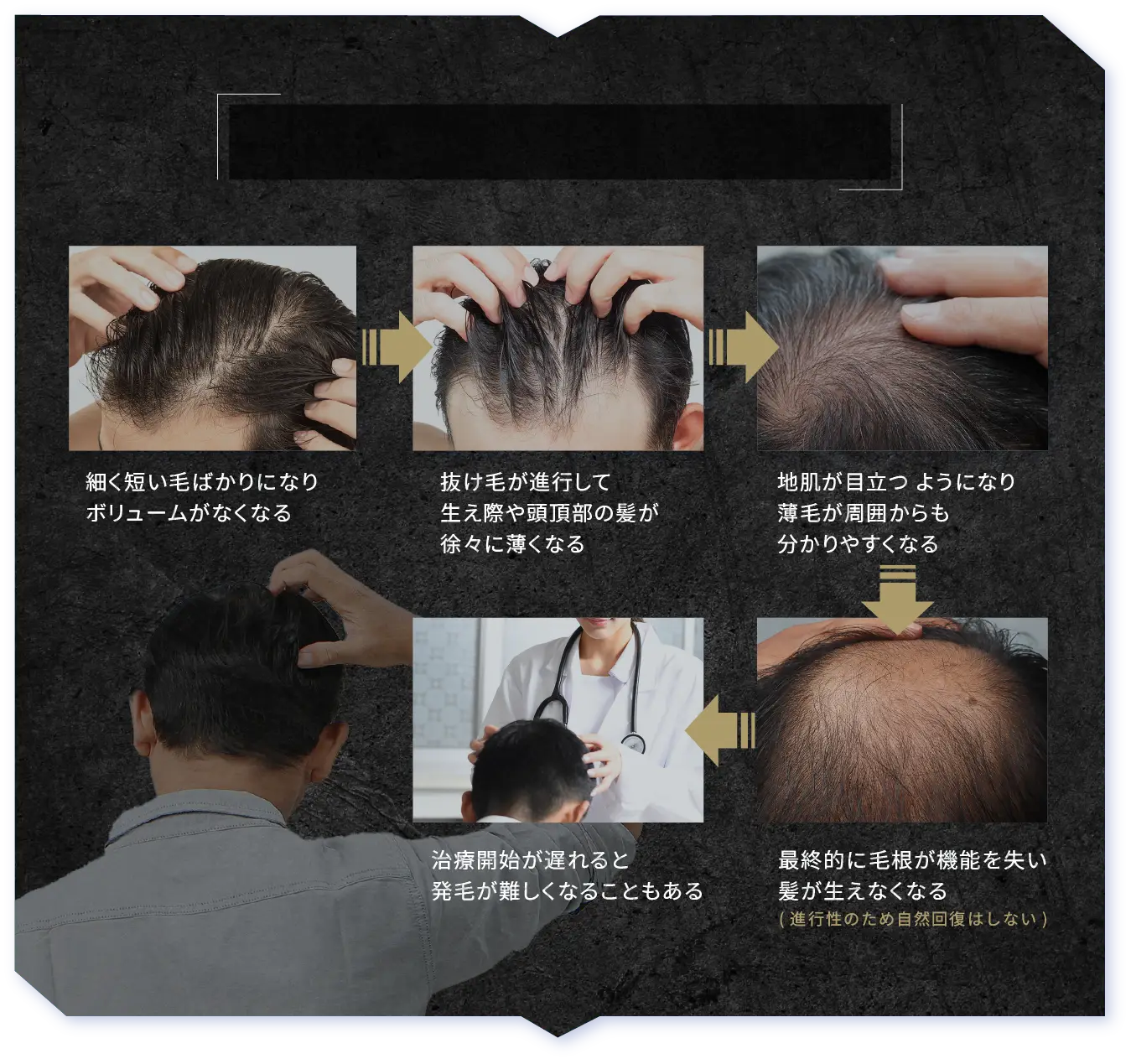 最終的に生えなくなる、発毛が困難