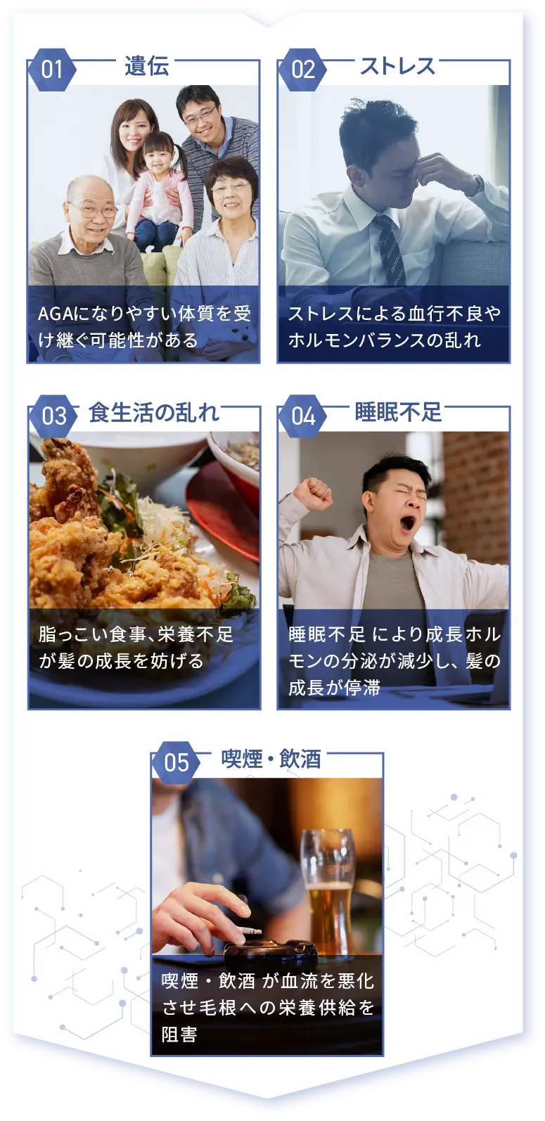 AGAの主に原因説明