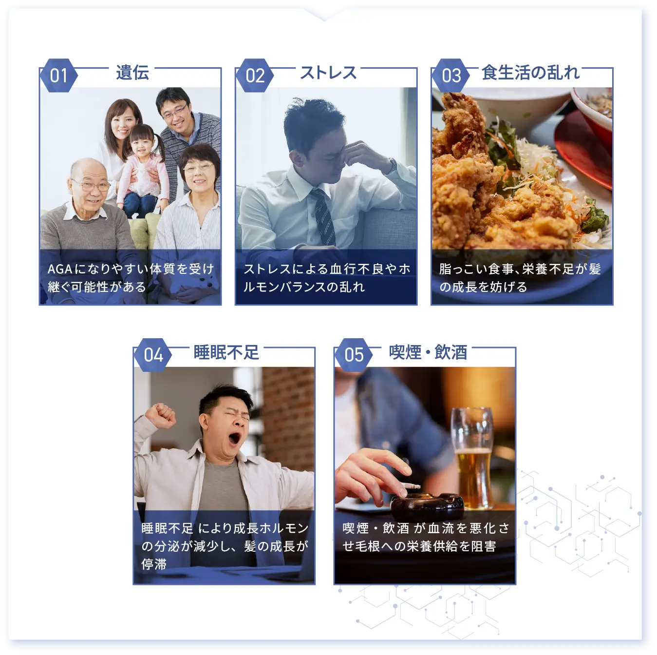 AGAの主に原因説明