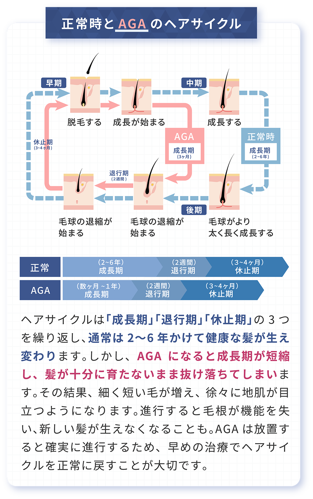 正常時のサイクルとAGAサイクルの差