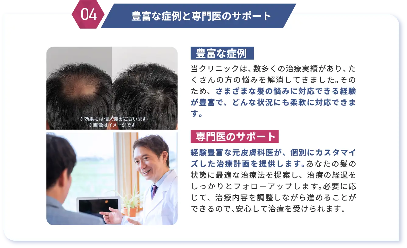 豊富な症例と専門医のサポート