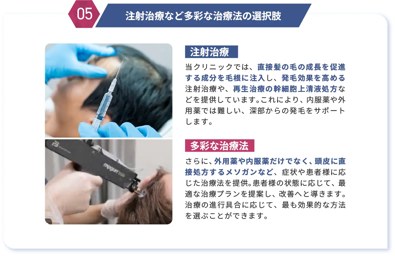 注射治療など多彩な治療法の選択肢