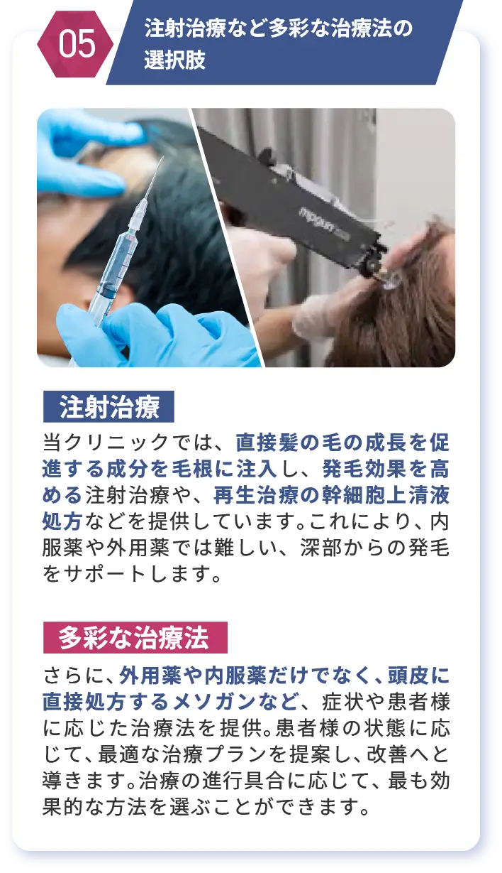 注射治療など多彩な治療法の選択肢